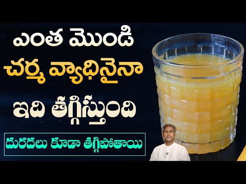 Reduces Skin Infections | మొండి చర్మ వ్యాధులను సైతం తగ్గించే ఈ జ్యూస్ ఎలా తయారు చేస్కోవాలో చూడండి.