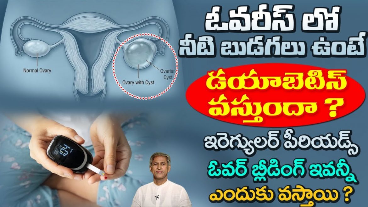 Ovarian Cysts:జుట్టు పల్చబడటం, మెడ చుట్టూ నలుపు ఈ లక్షణాలు మీకు ఉన్నాయా?
